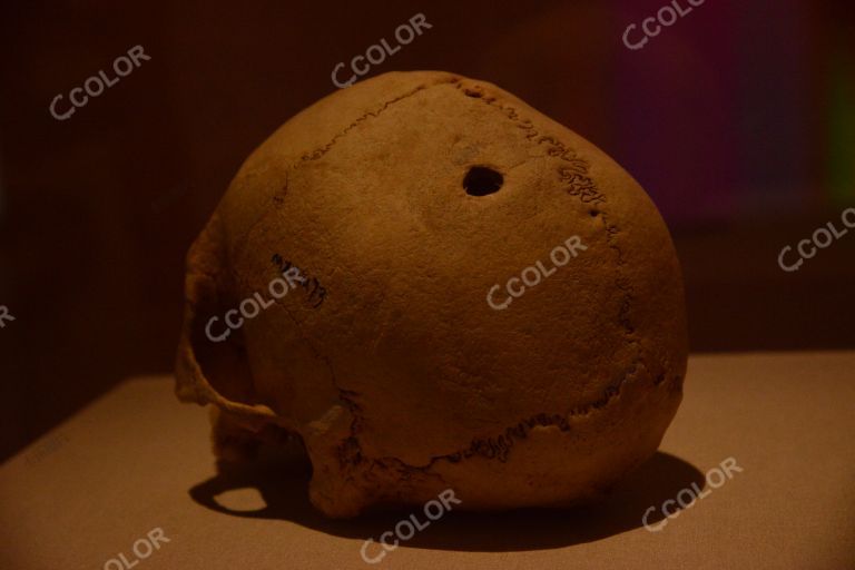 古中医脑外科手术的见证，新石器时代马家窑文化头骨